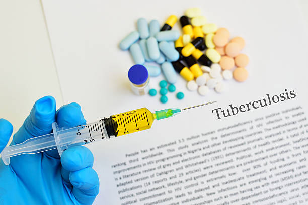 Tuberculosis Treatment: Understanding Effective Options