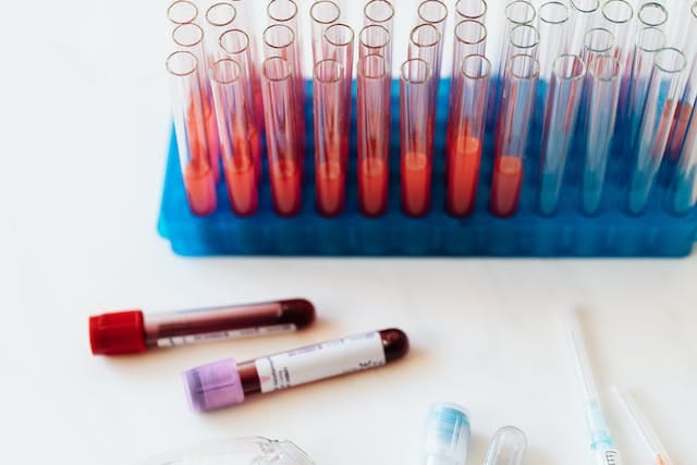 What is a Procalcitonin test? What's the PCT Normal Range?