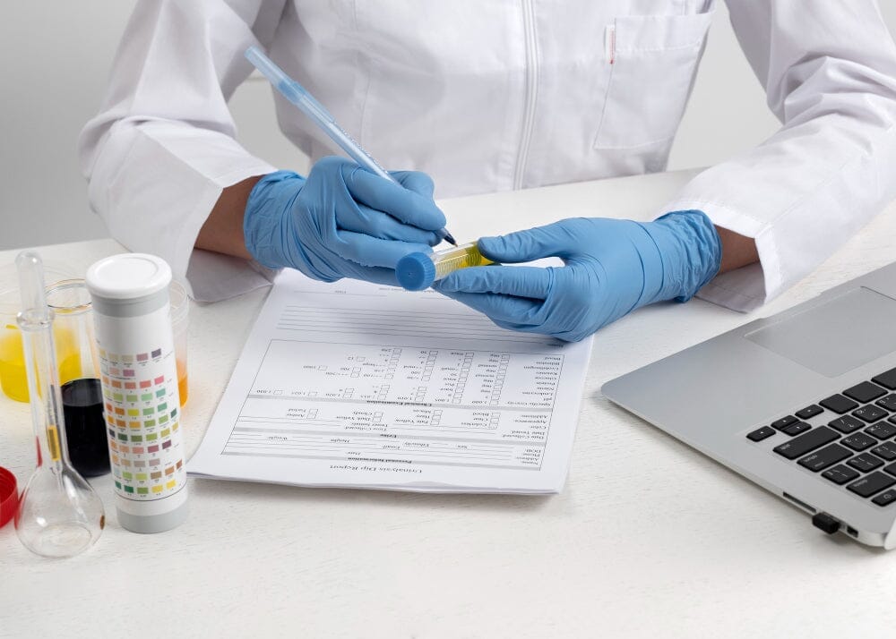 What is a urine infection test? Can it detect a UTI?