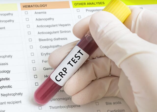 How much CRP level is Dangerous? What are the Symptoms?
