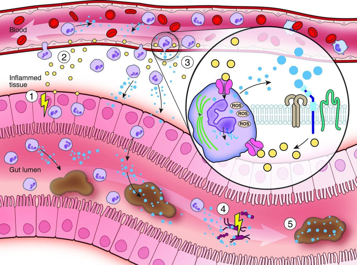 Fecal Calprotectin | Inflammatory Bowel Disease