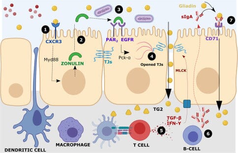 Zonulin | Zonulin and its Role in Autoimmune Diseases