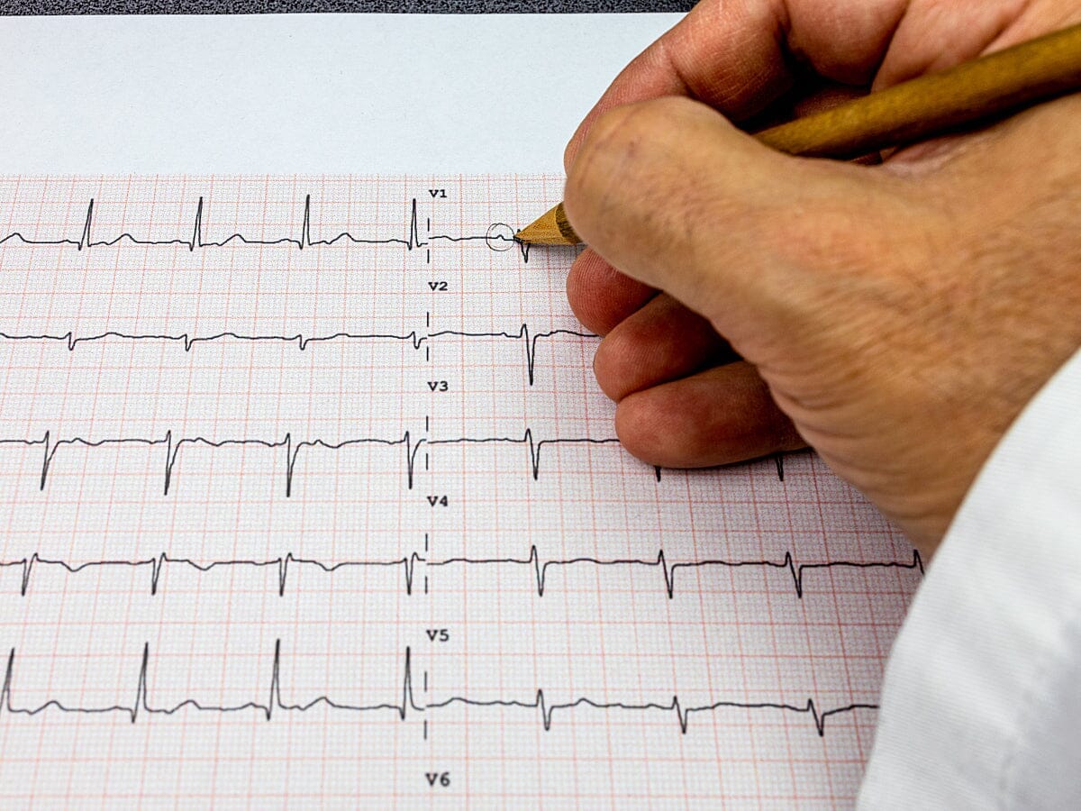 How to Prepare for an ECG Test: What to Expect Before, During, and After