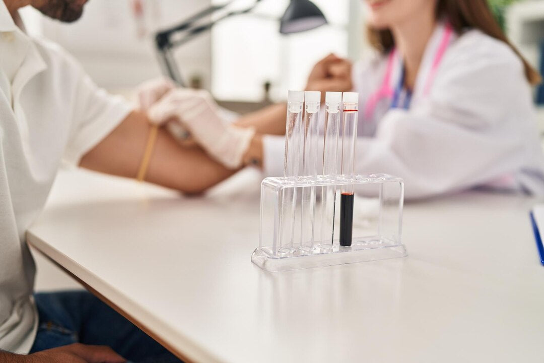 Understanding the AMH Test: Purpose, Procedure, and Results Explained