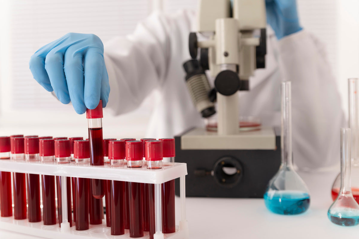 Activated Partial Thromboplastin Time | Blood Tests | Understanding APTT | Bleeding Disorder |