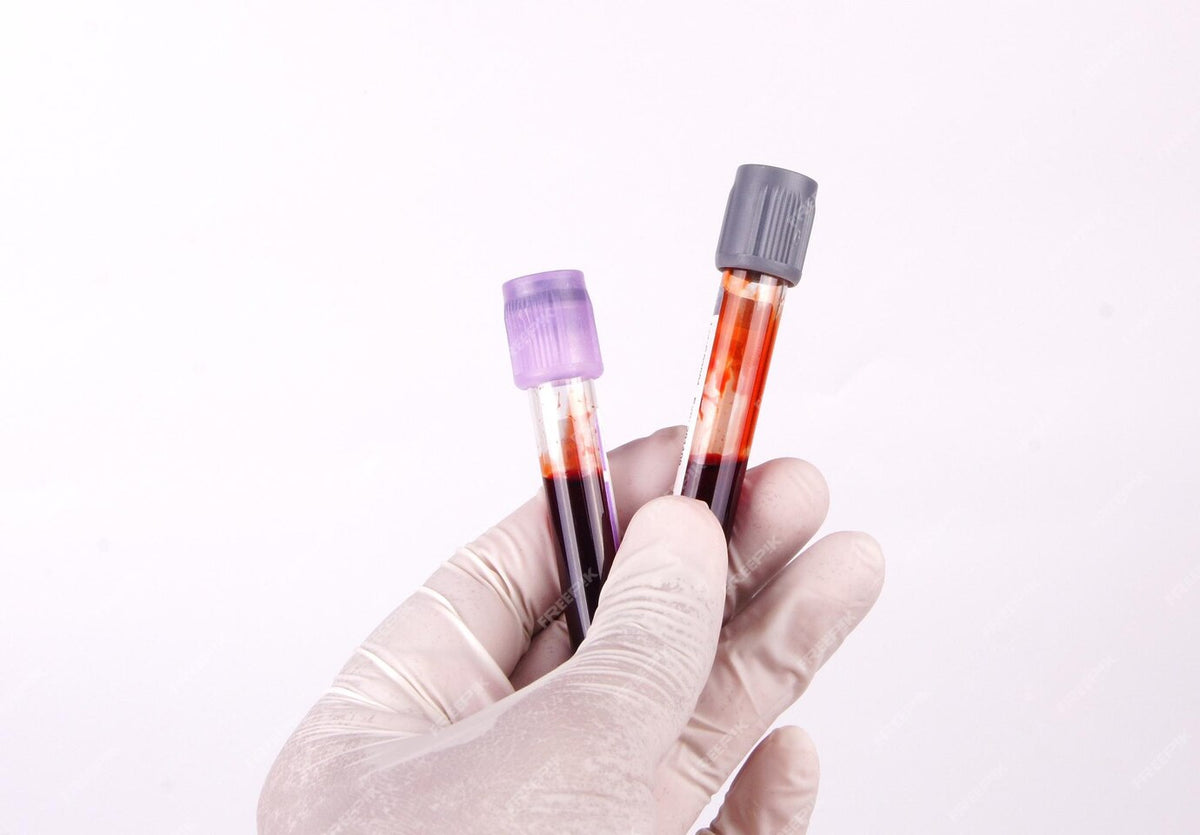 ALT Blood Test: What High Alanine Aminotransferase Levels Mean for Your Liver Health