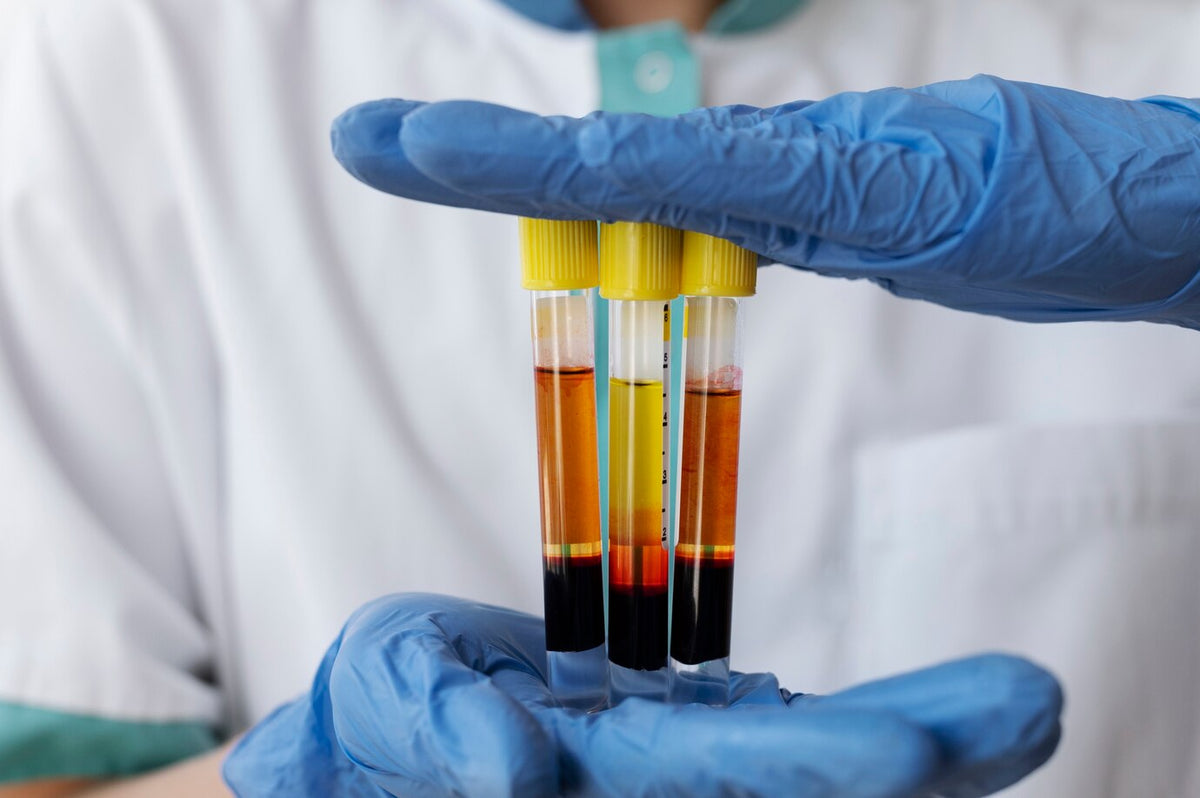 Albumin Levels Explained: Normal Ranges, Tests & What Trace Means in Urine