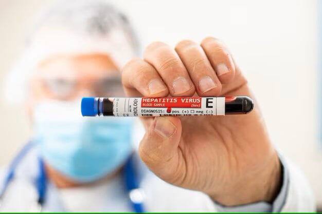 Understanding the SGPT Test: Uses, Results, and Normal Range