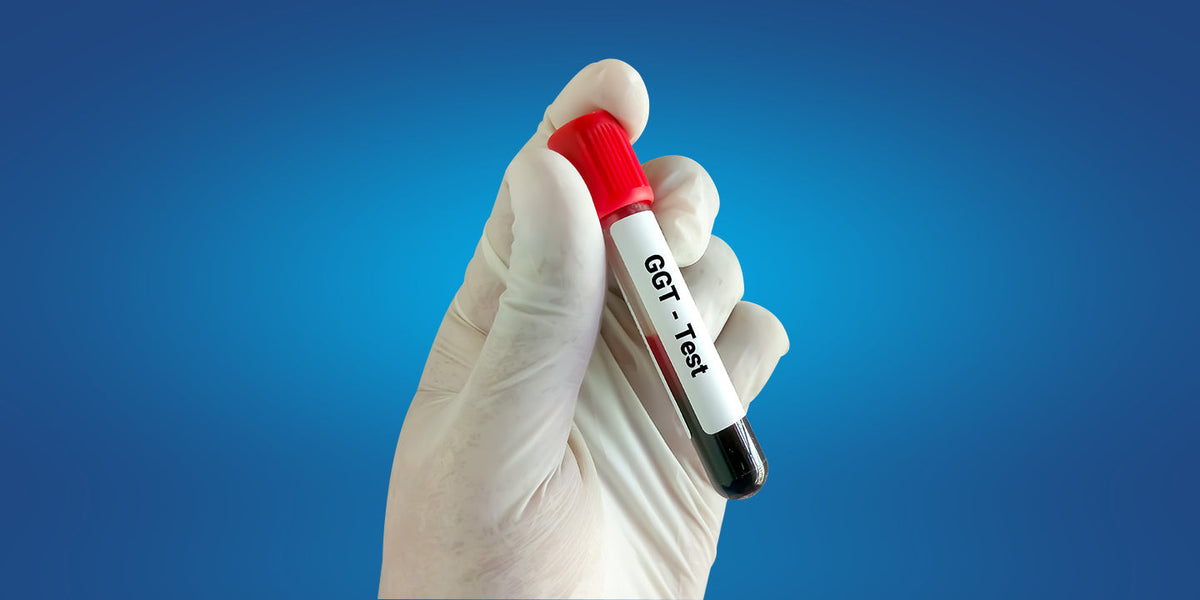 GGT Test: Understanding Gamma-Glutamyl Transferase and What High Levels Mean