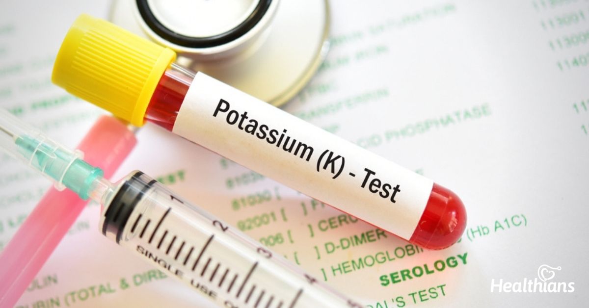 Potassium in the Body: Normal Levels, Deficiency, and Hyperkalemia Explained