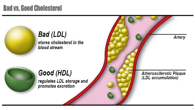 High Chol/HDL Ratio: What It Means for Your Health