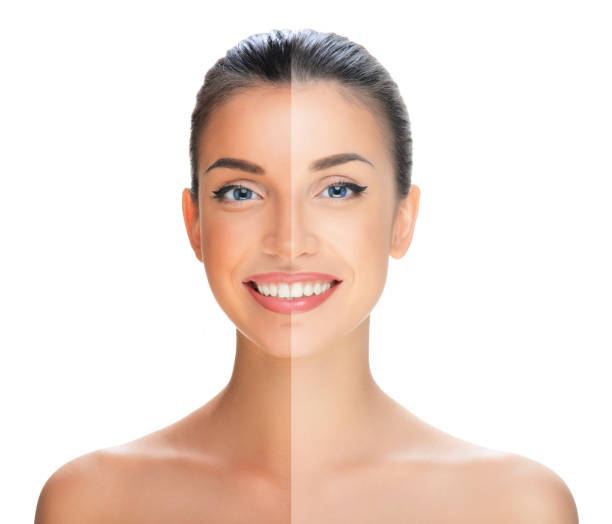 How to Remove Tan from Face Immediately: Home Remedies That Work
