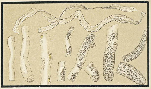 Epithelial Cells in Urine: Normal Range, Causes & What it Means