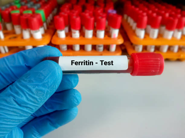 Ferritin Test: Purpose, Normal Range, & Results