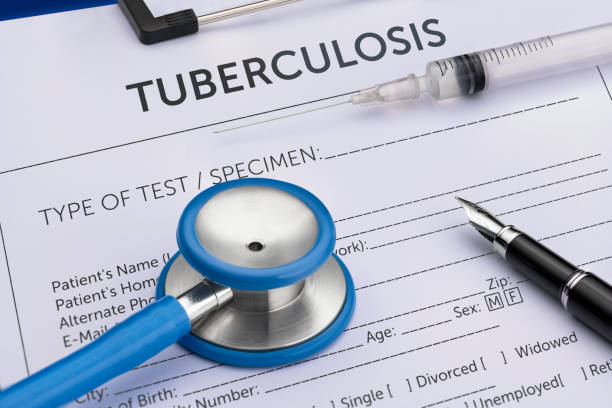 TB Test Guide: Types, Procedure, Cost , and Results