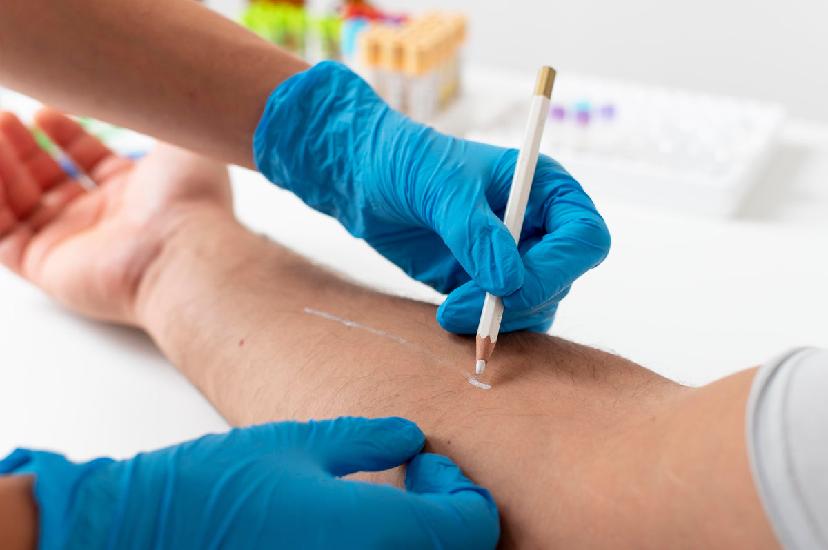 Mantoux Test | Tuberculin Skin Test | Latent Tuberculin Infection |