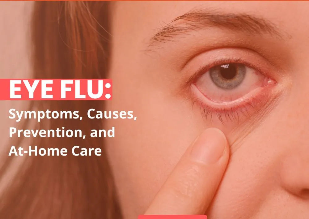 Understanding Eye Flu Symptoms, Causes And Treatment Options