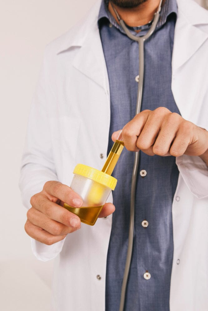 Glucose in Urine: Causes, Symptoms, and What It Means for Your Health