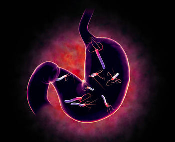 Does H. Pylori Cause Stomach Cancer? Risk, Symptoms, and How It Differs From an Ulcer