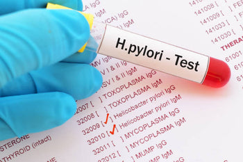 H. pylori Test Positive | Here's what an H pylori test positive means for patients