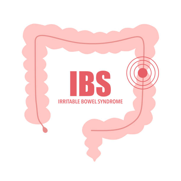 Irritable Bowel Syndrome (IBS)