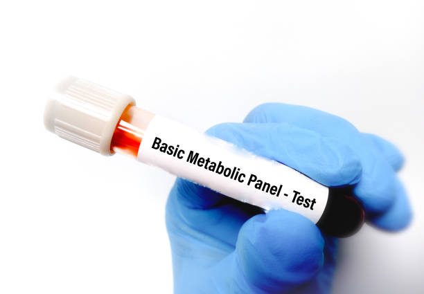 metabolic test | metabolic test preparation