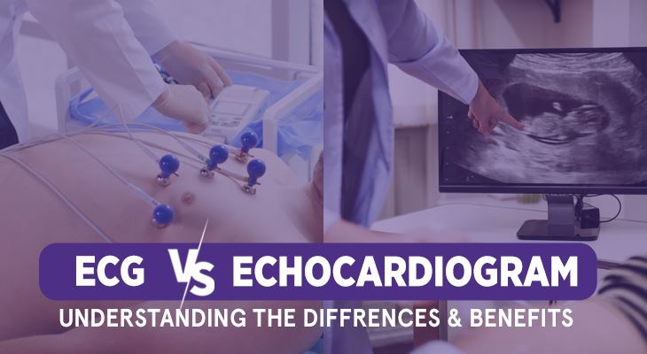 ECG vs. Echocardiogram: What’s the Difference?