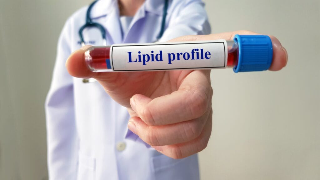 Lipid Profile for Children: When and Why Should Kids Get Tested?