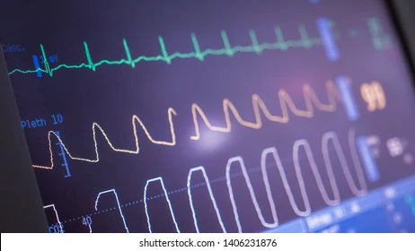 Common Heart Problems Detected by an ECG Test