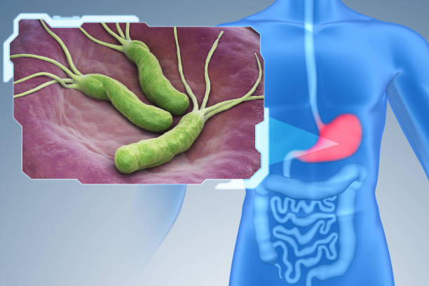 H. Pylori Treatment
