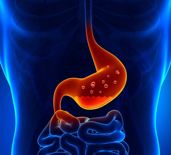 GERD (gastroesophageal reflux disease)