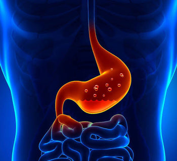 GERD (gastroesophageal reflux disease)