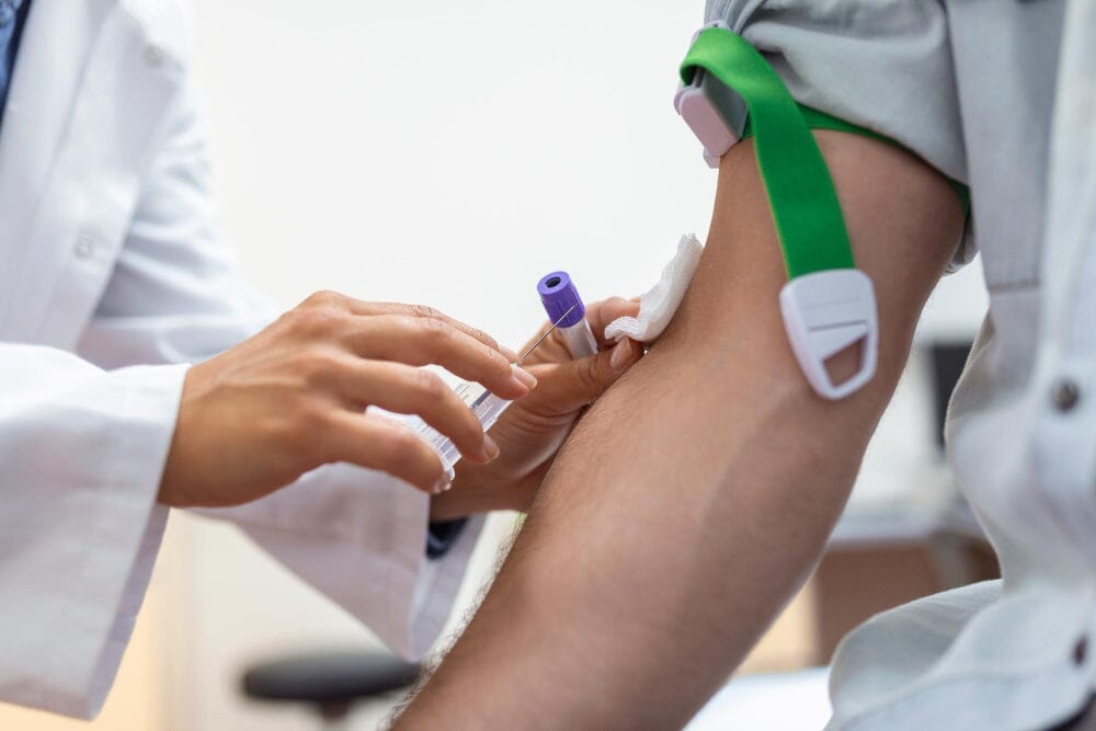 What's the TLC Normal Range and When to Get Leucocyte Count Tested