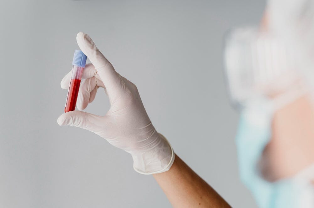 What is the Golden Blood Group? Why should I check my Blood Group?