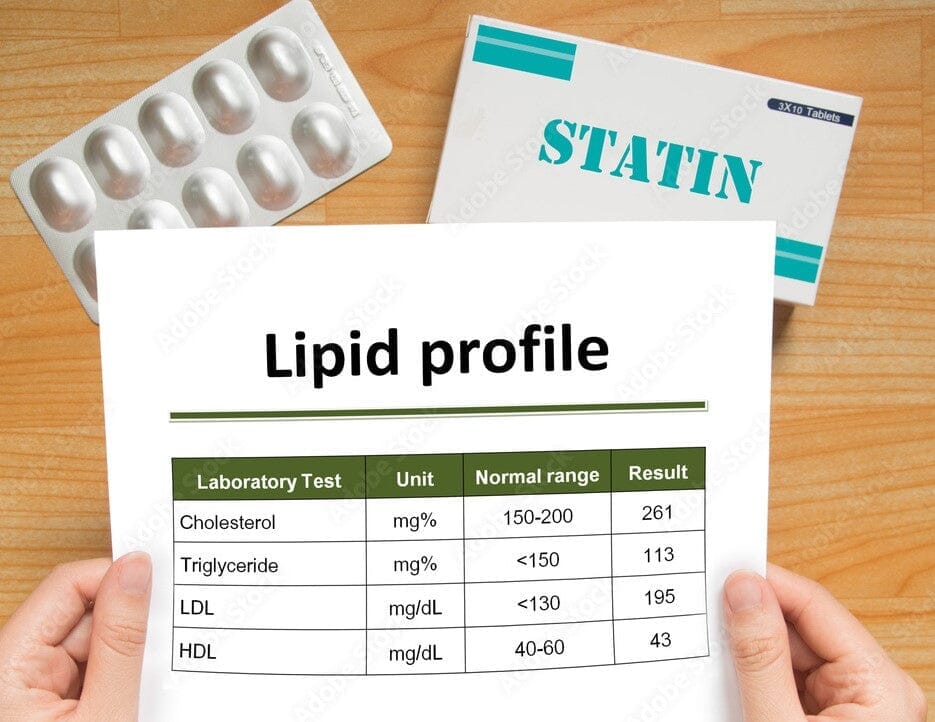 What is a Lipid Test? What's the Lipid Profile Test Normal Range?