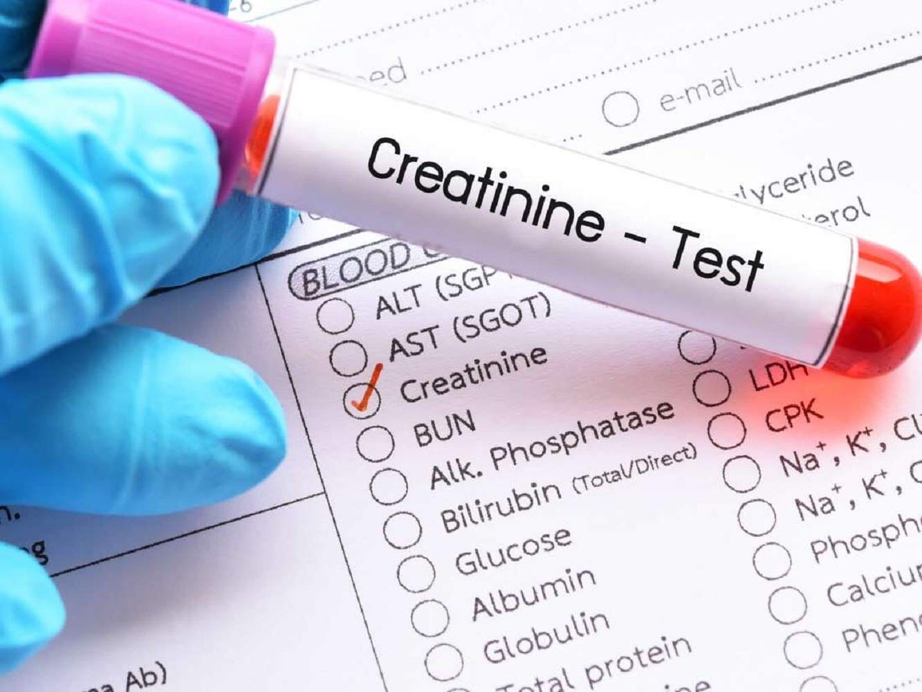 What are Normal Creatinine levels? Is Creatinine level 1.7 Dangerous?