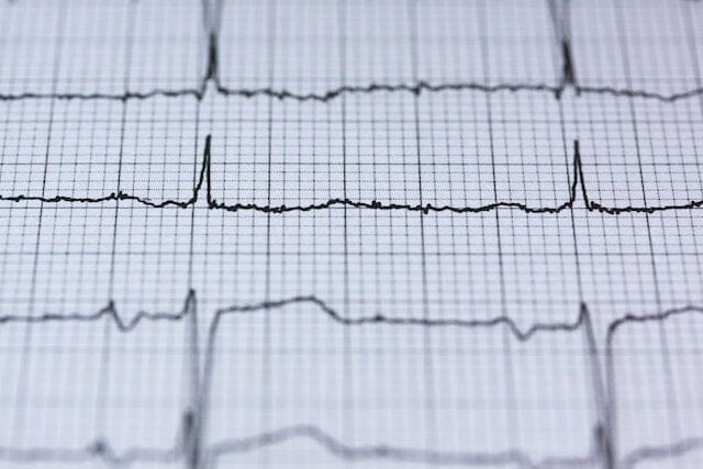 What is the difference between ECG and ECHO tests?