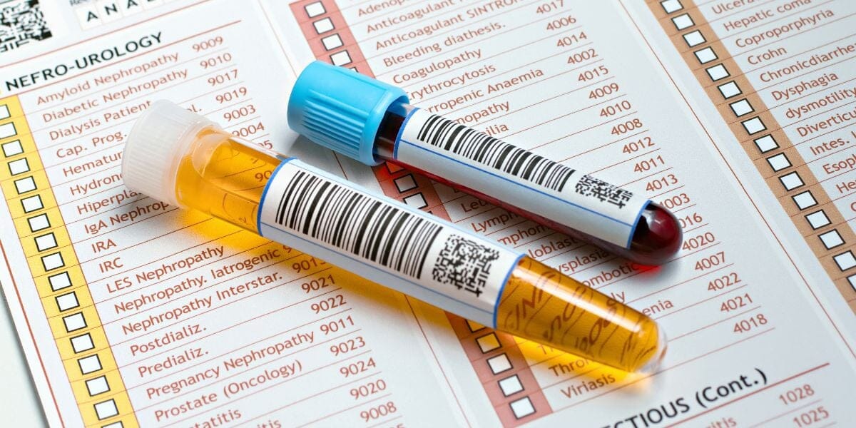 When should I take the GTT test? What is the GTT test Normal range?