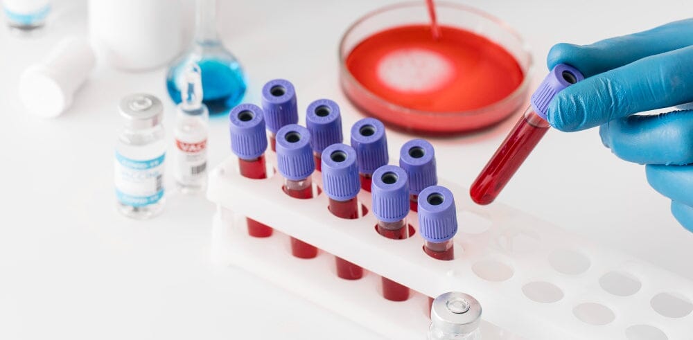 What is a CBC test? How do I get the best CBC test price?