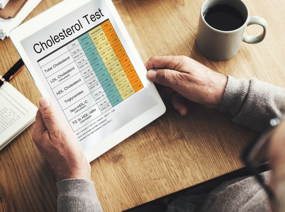 What is a lipid panel? How do I get the best lipid profile test price?