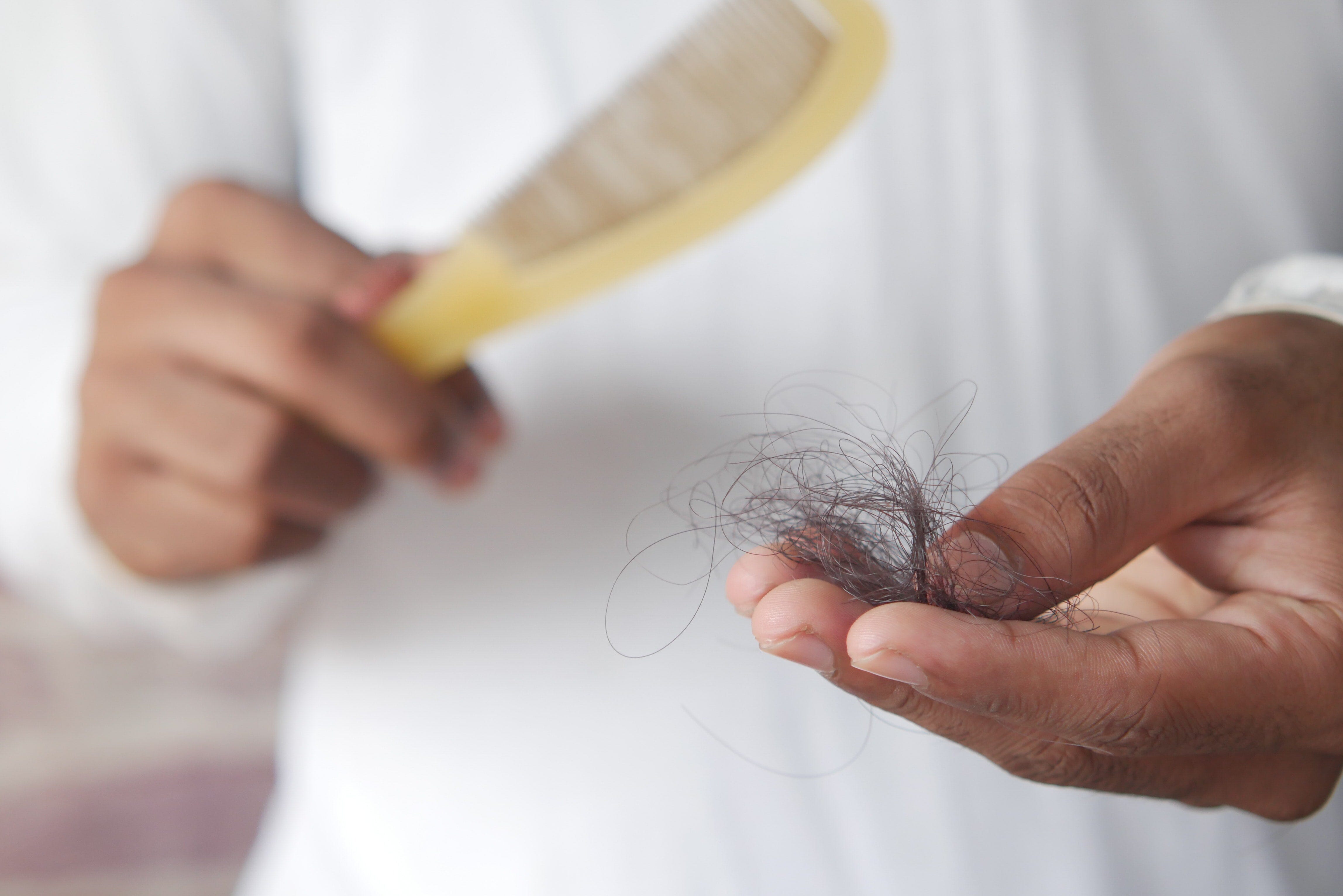 How to Stop Hair Fall