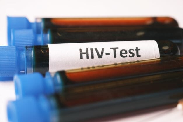 Can HIV be cured at early stage?