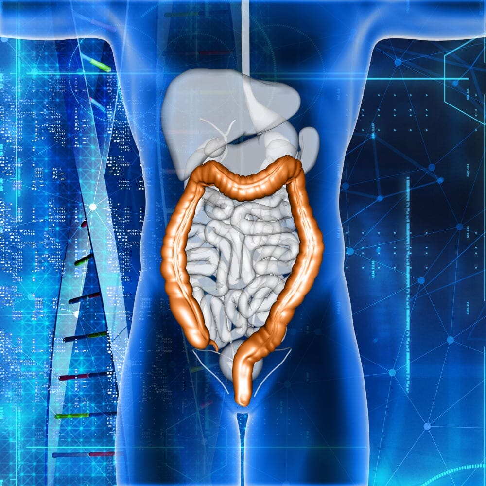 What Is Crohn's Disease?