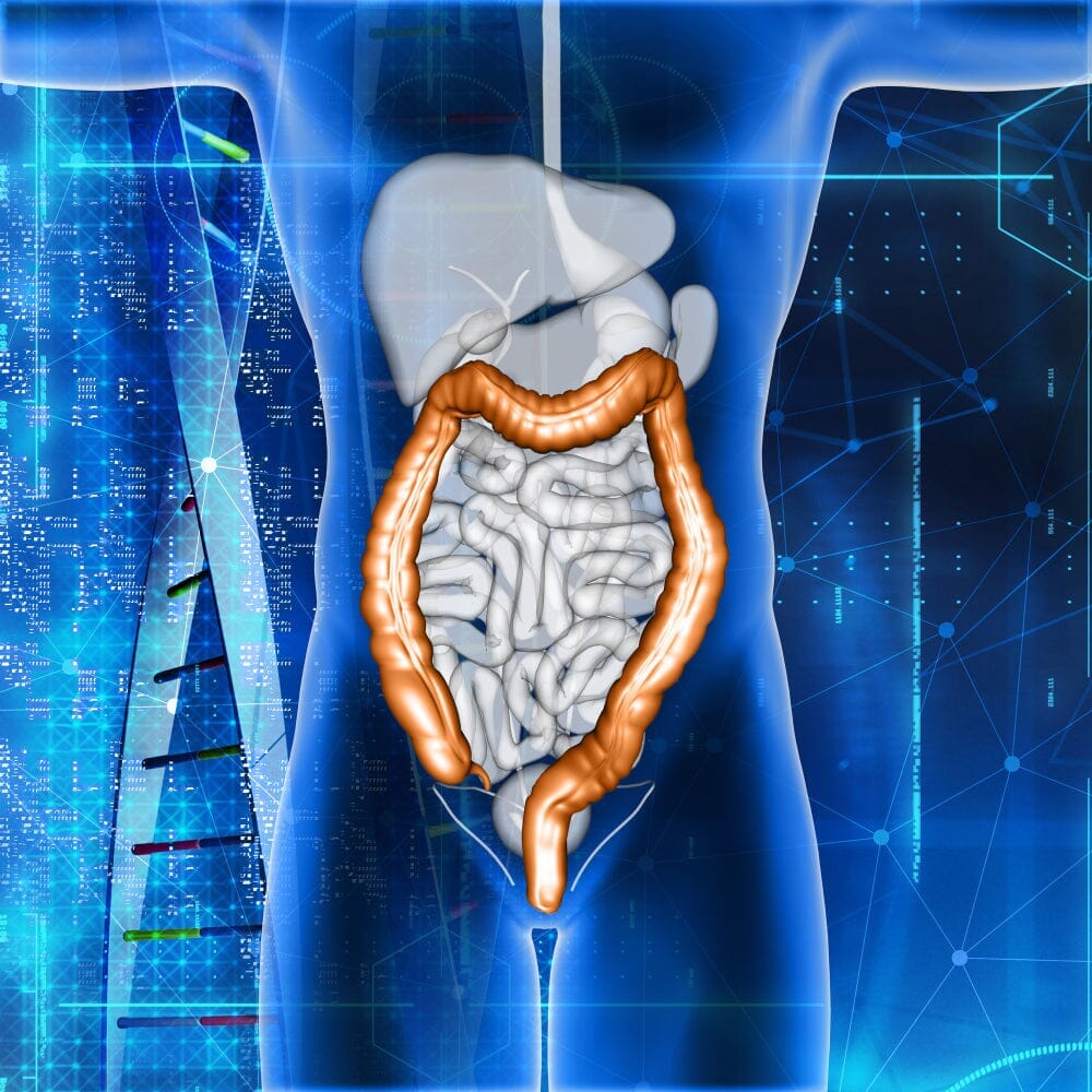 What Is Crohn's Disease?