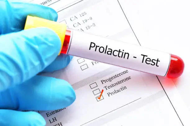 What is the Prolactin Test Normal Range? What does High PRL mean?