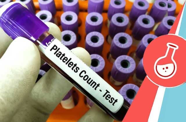 What is the PLT test? What's the PLT normal range? – MyDiagnostics