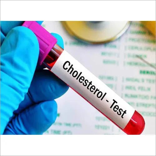 What is the Cholesterol Test Price? How Often Should I Check?