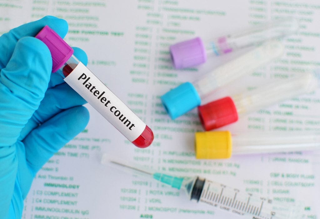 Platelet count blood test: Normal, low, and high values