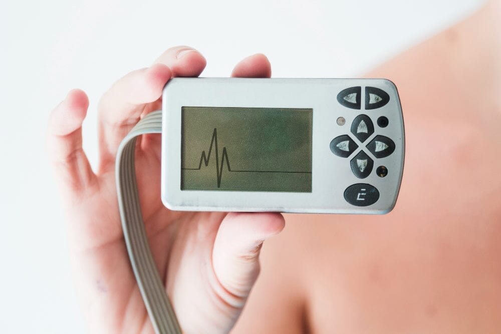 What is the Average Cost of ECG or Electrocardiogram?