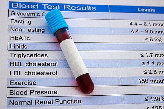 High Chol/HDL Ratio: What It Means for Your Health